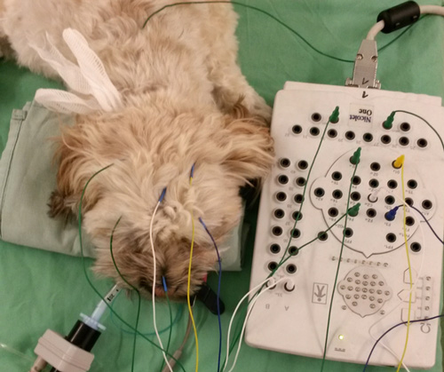 Elektroenzephalogramm (EEG) zur Messung der Hirnströme kann wach oder in Sedation gemacht werden.
