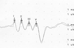 AEP-Dalmatinerwelpe