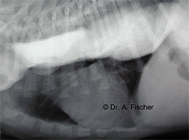 Myasthenia gravis